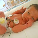 Breastfeeding Success After Preemie in NICU