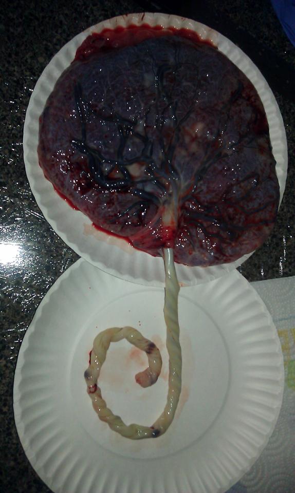 placenta encapsulation 